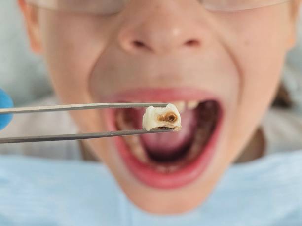 Best Emergency Gum Treatment in Point, TX